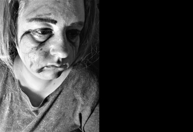 Schwarzes und weißes Foto einer Frau mit Gesichtsverletzungen, ernster Gesichtsausdruck, konzentrierter Blick, zurückgebundenes Haar, trägt ein T-Shirt.